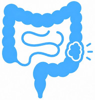 Darmkrebs_Icon.jpg Darmkrebs_Icon.jpg